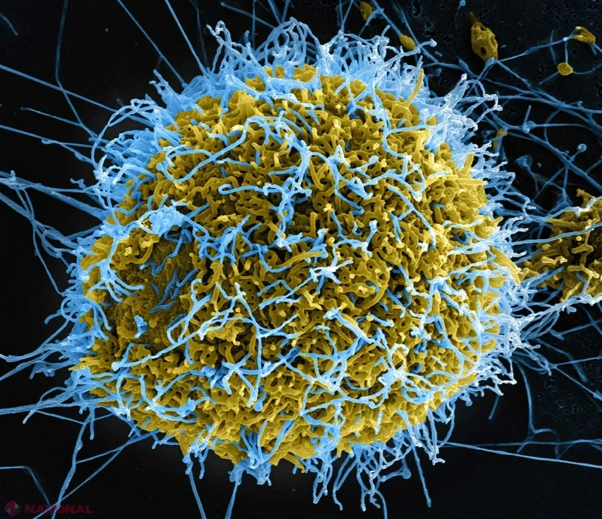 Extinderea epidemiei de Ebola în statele africane