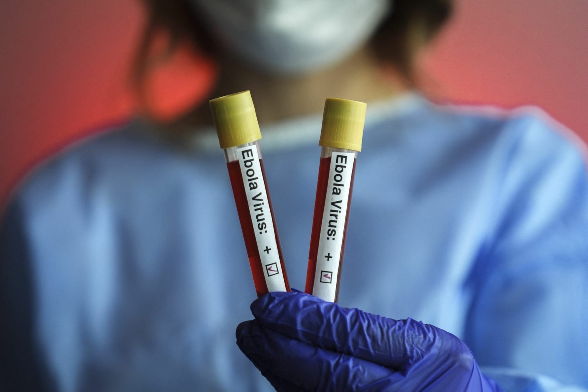 Situația epidemiei de Ebola în Kenya și Africa