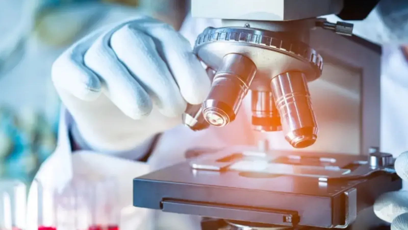 Studiu privind riscul de cancer colorectal după apendicită