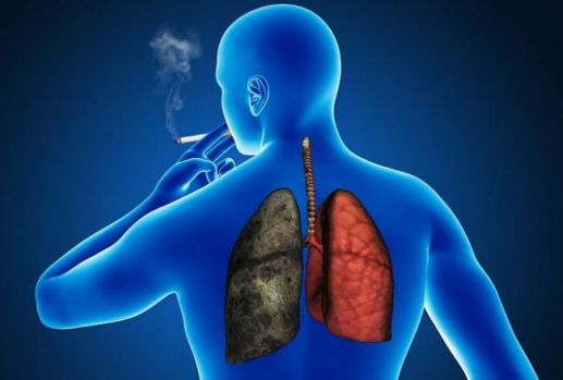 cancerul pulmonar, cum sa, vitamina B6, metionină, tratament revoluționar